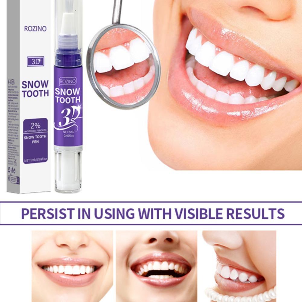 Portable Teeth Whitening Pen E - Teeth Whitening Pens ulasan dan harga
